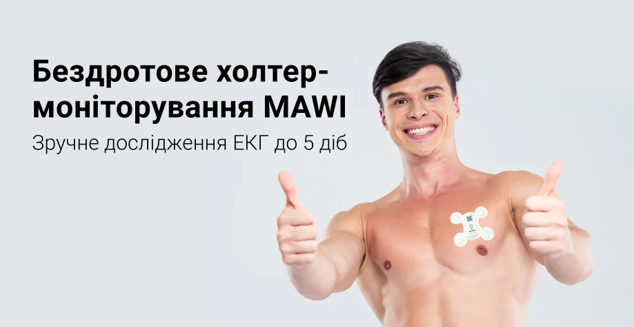 Бездротовий холтер-моніторинг ЕКГ (Mawi) в Києві