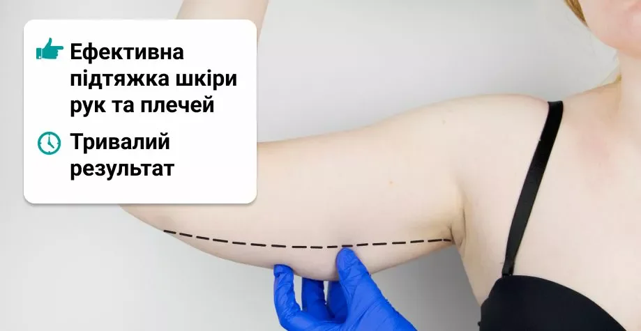 Підтяжка шкіри рук (брахіопластика)