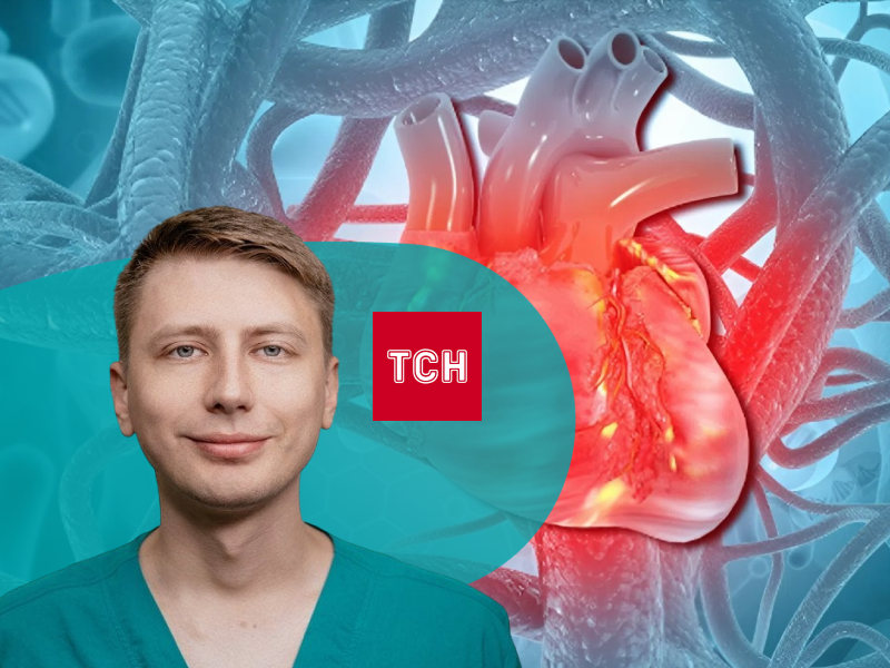 інсульт