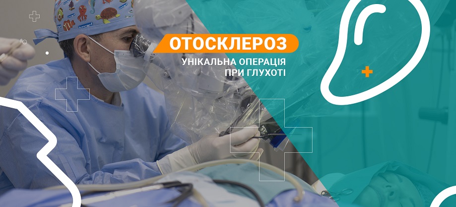 Стапедопластика лікування отосклерозу