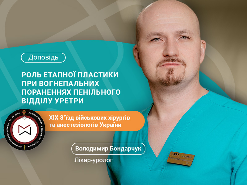 Бондарчук