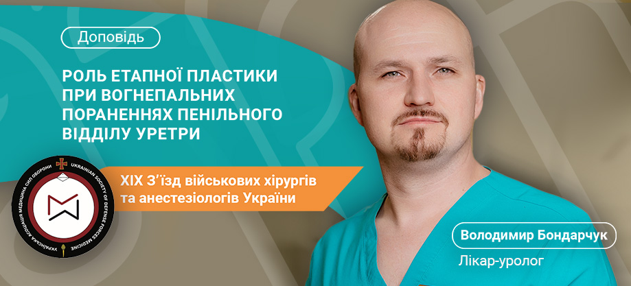 Бондарчук