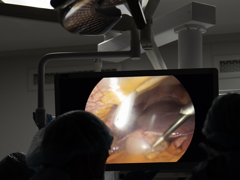 лапароскопія черевної порожнини