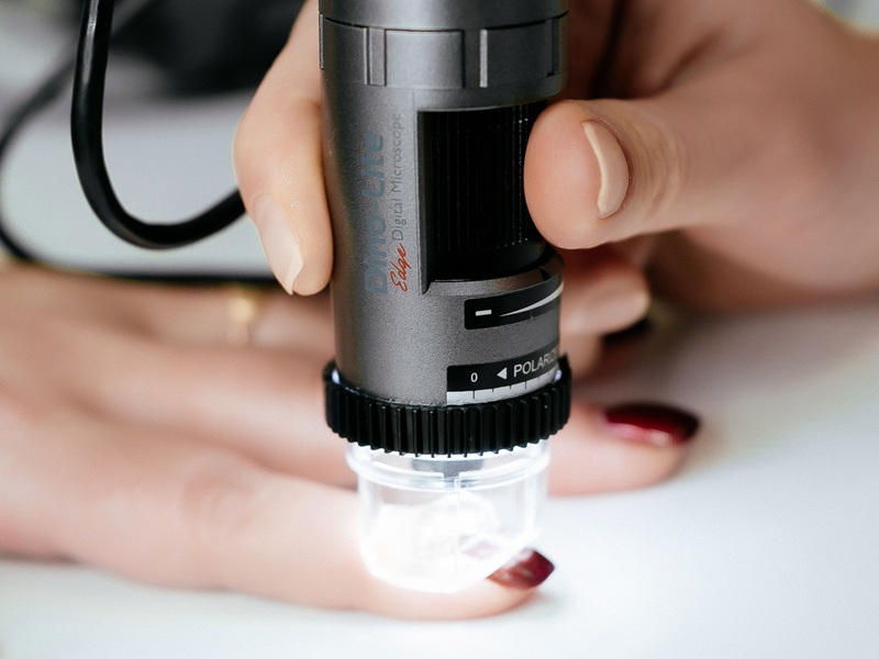 Склепротерапія в Києві склероскопія