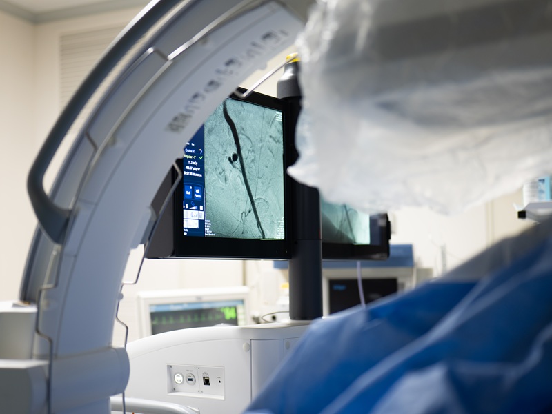 ангіографія