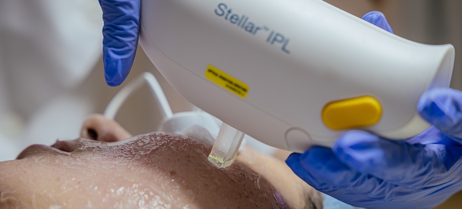 IPL-апарат IPL-апарат