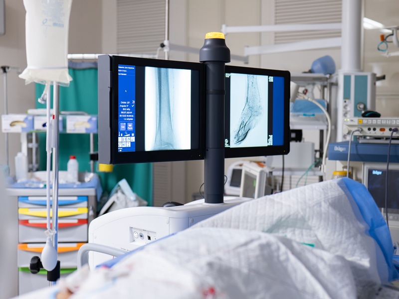 МР-ангіографія в Києві mrt angiografia