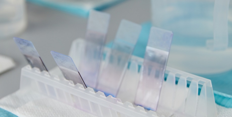 зробити біопсію