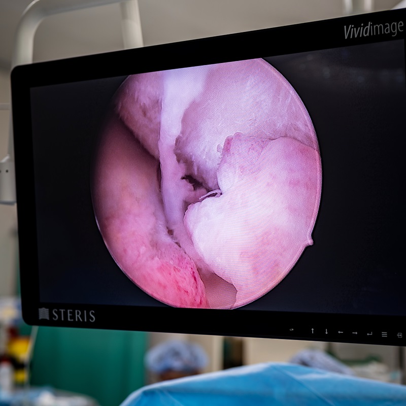 Артроскопія відео артроскопія Київ