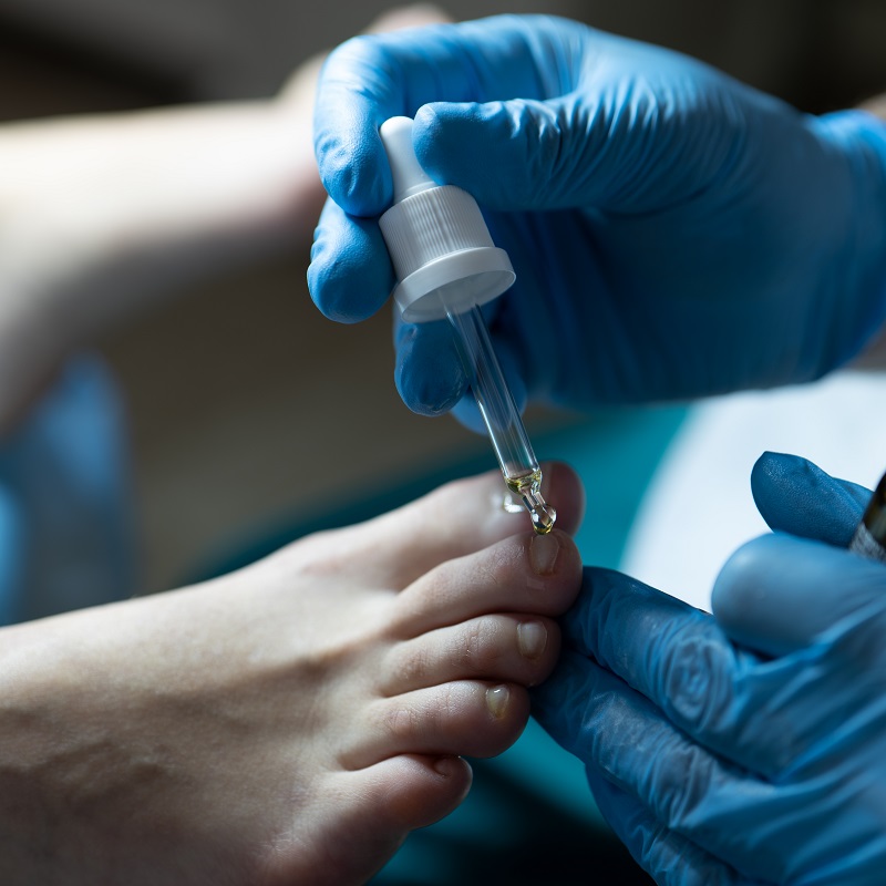 медичний педікюр