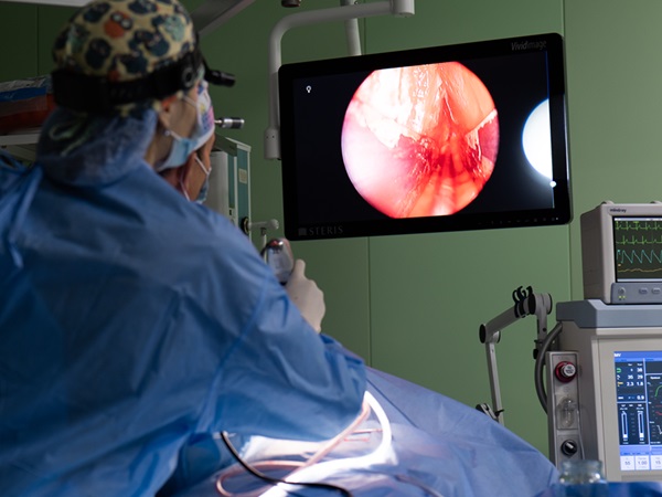 видалення остеоми