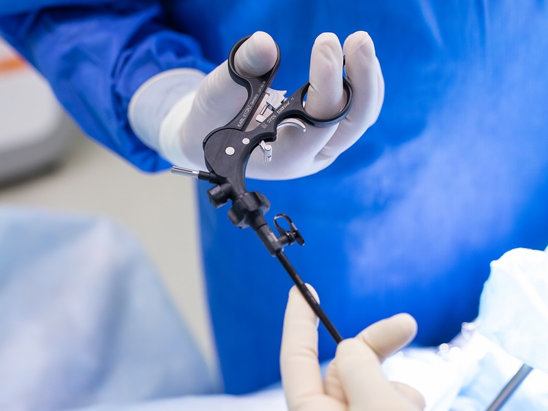 лапароскопічна операція