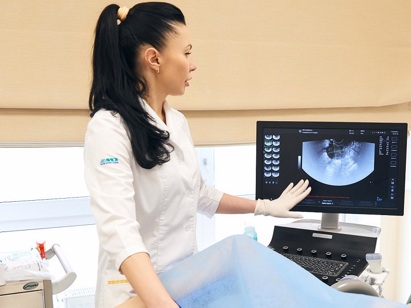 трансвагінальне УЗД в Києві