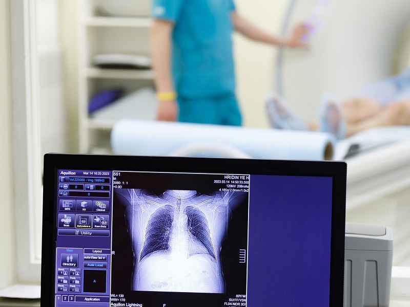 КТ легенів на Оболоні