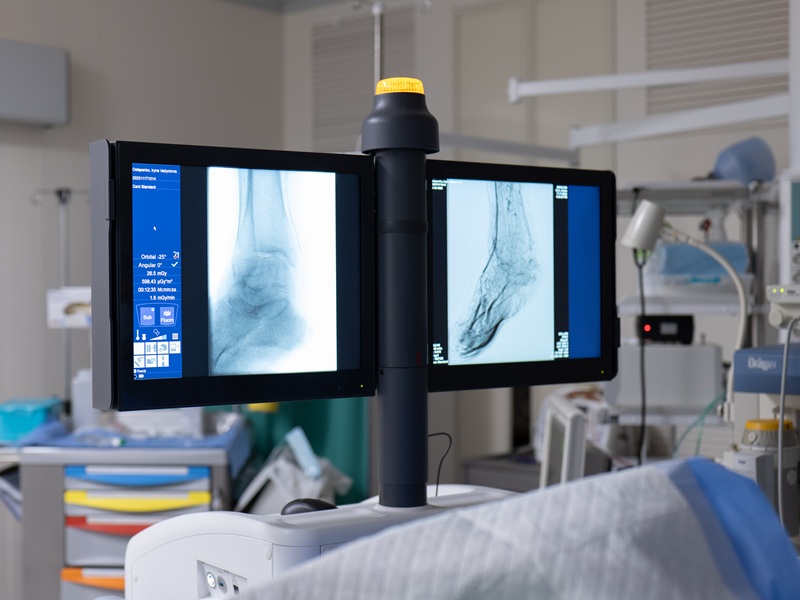 Ангіографія в Києві ангіограф