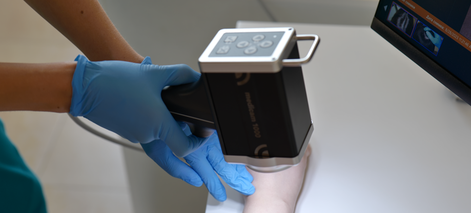 видалення родимки