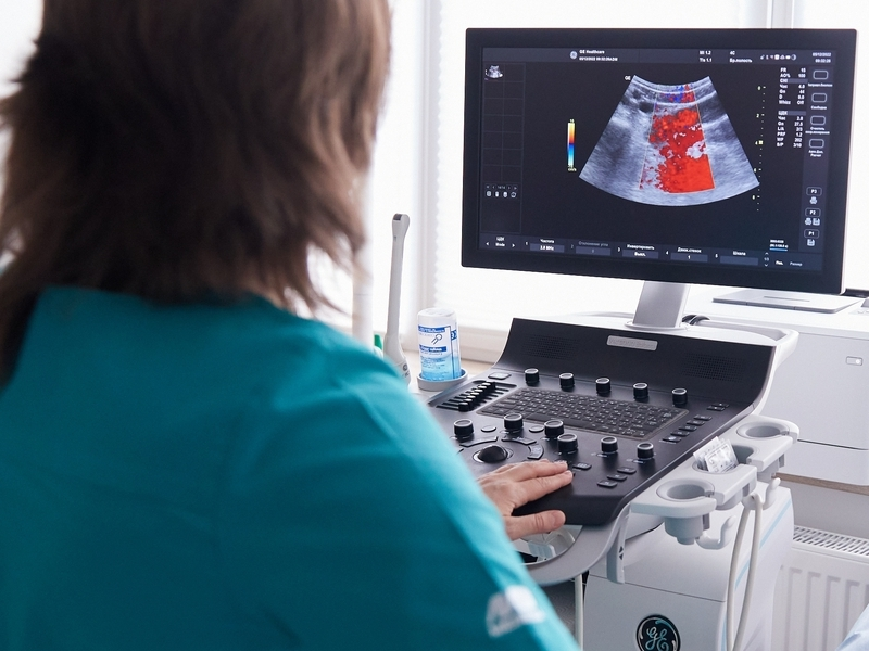 УЗД органів малого тазу діагностика в гінекології