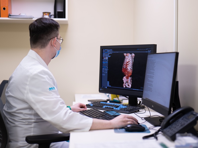 КТ результат