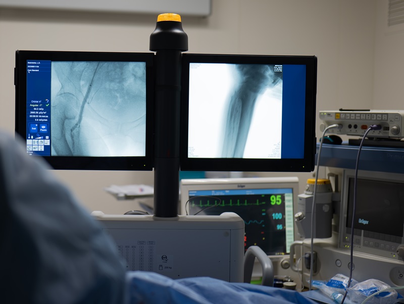 рентген контроль