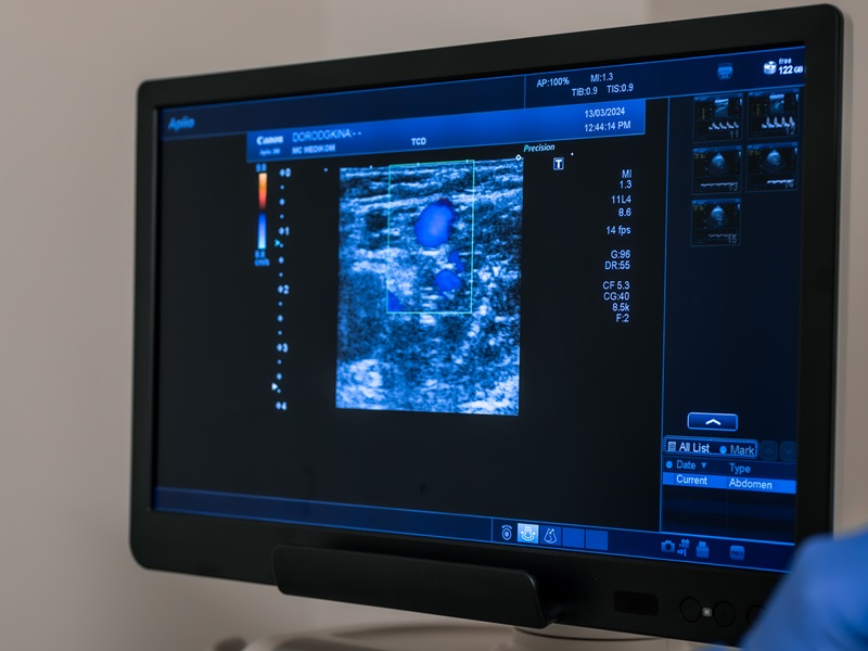 узд вен артнрій нижніх кінцівок