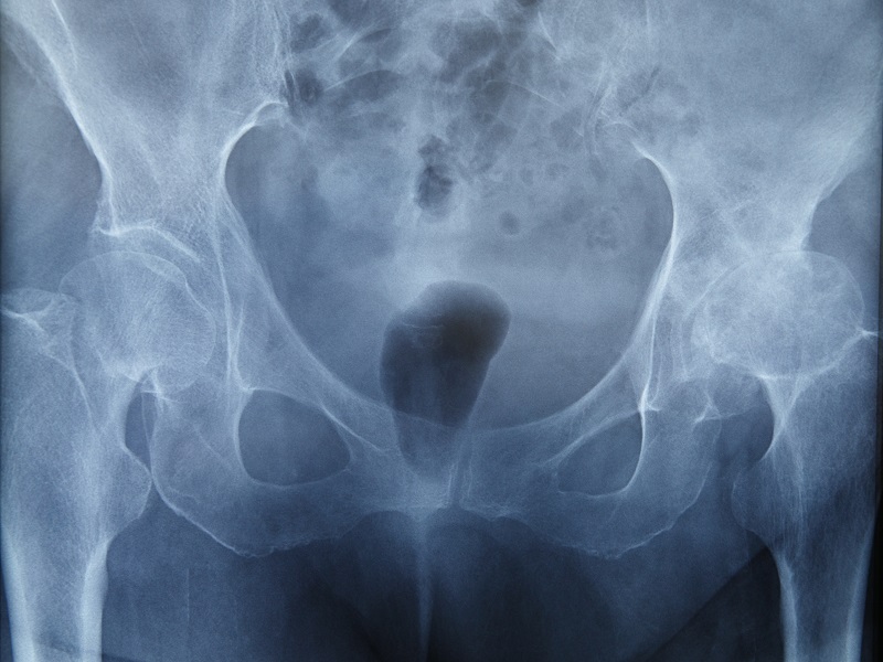 Урографія в Києві