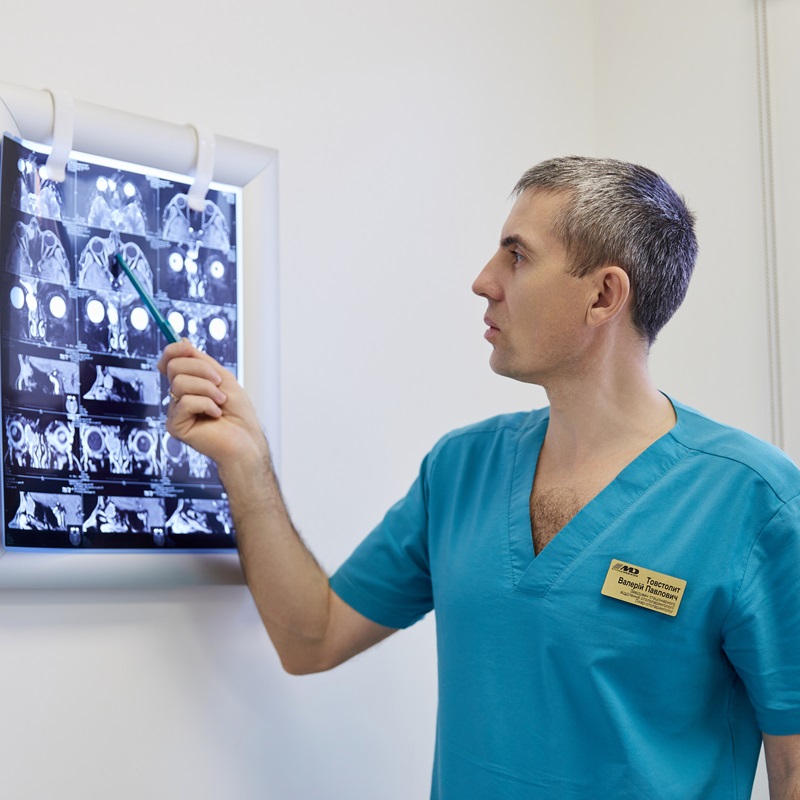 знімок кт носа