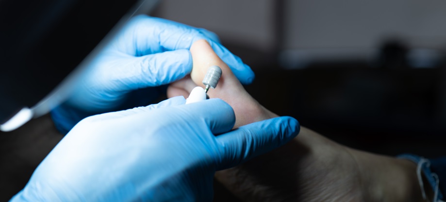 Обробка стоп