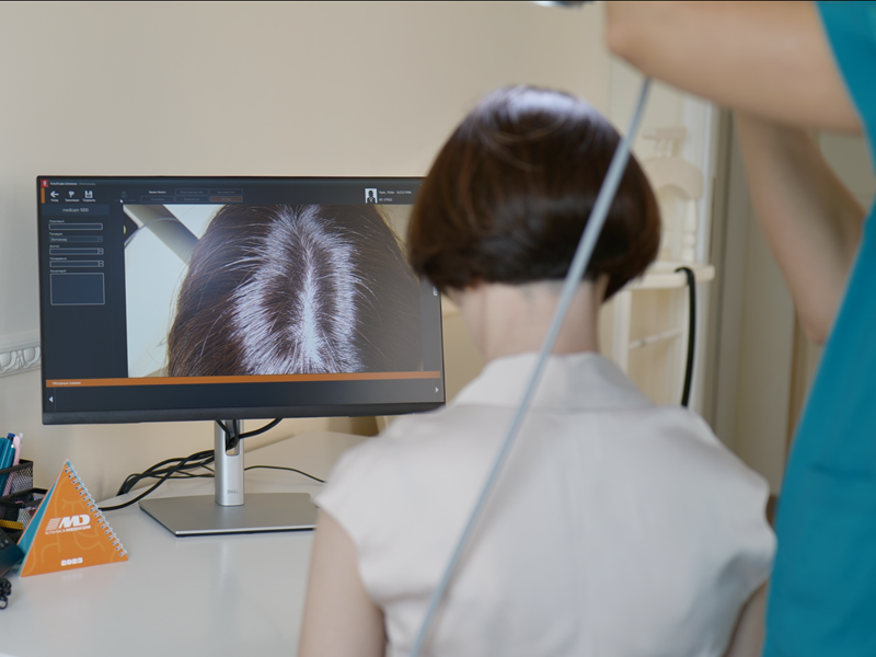 діагностика шкіри голови