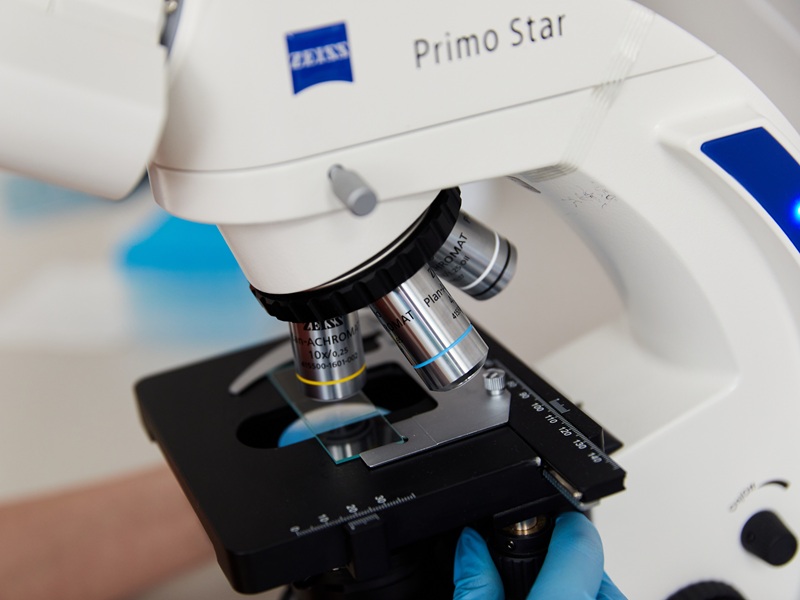 аналіз після укусу кліща