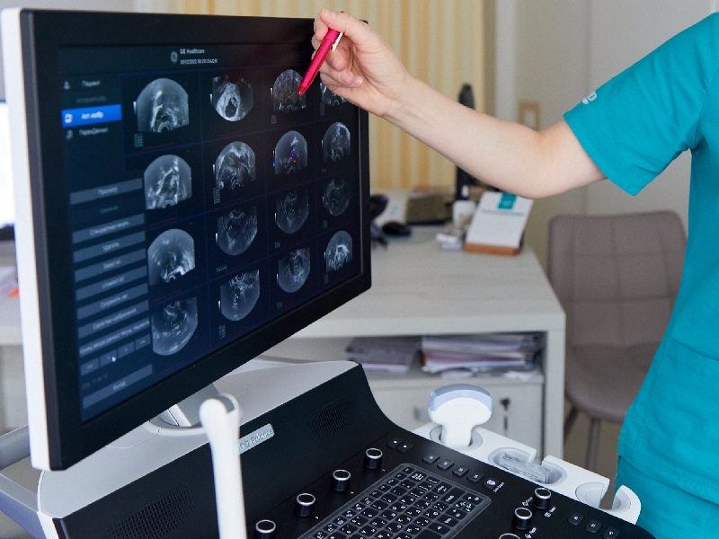 УЗД яєчники