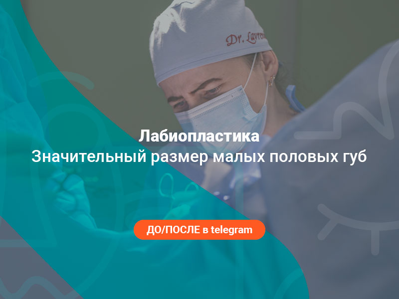 изменение размера половых губ