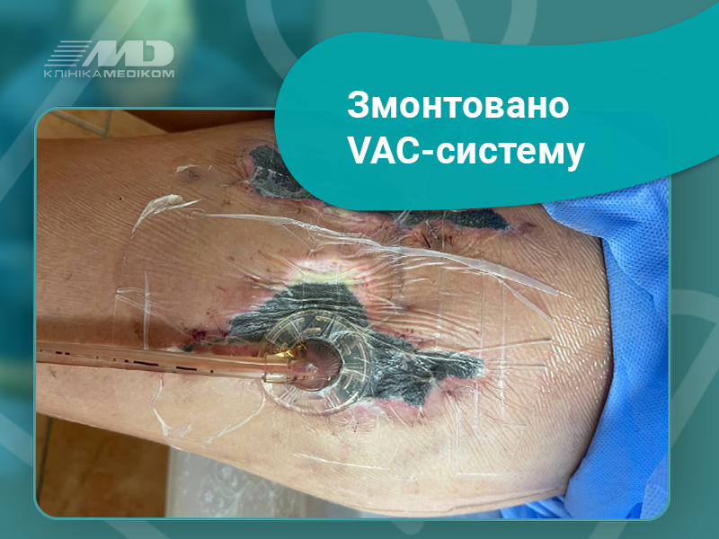 ВАК-система