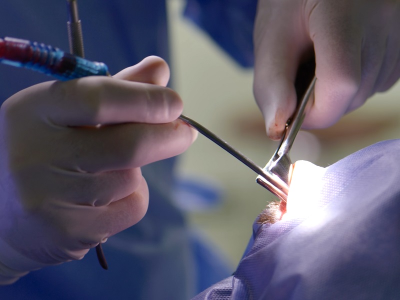 Вирівнювання носової перегородки в Києві вирівнювання носової перегородки