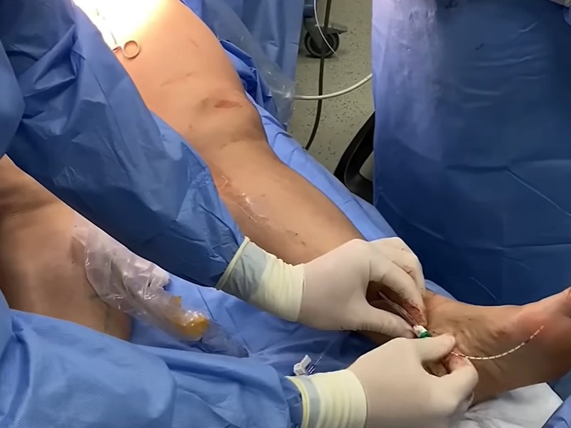 судинна хірургія судинна хірургія