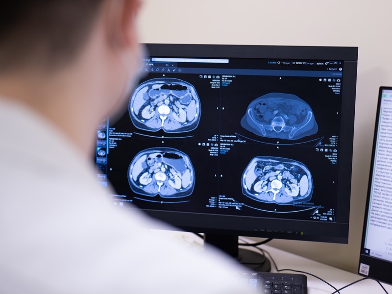 КТ результат