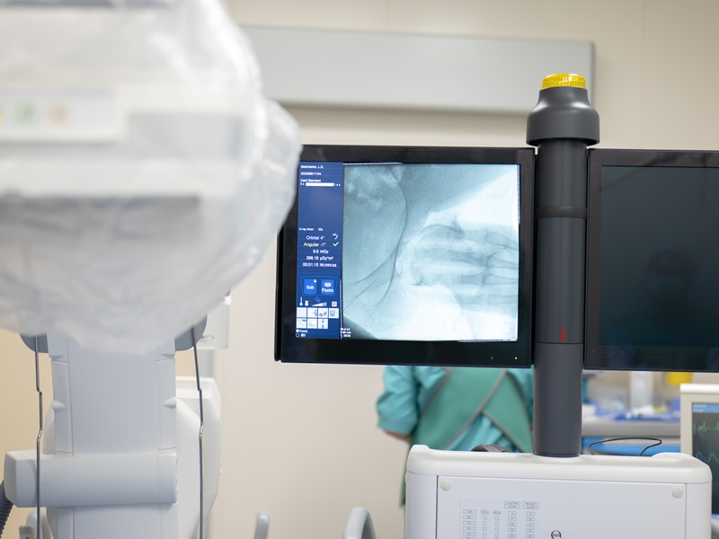 КТ-ангіографія kt angiografia