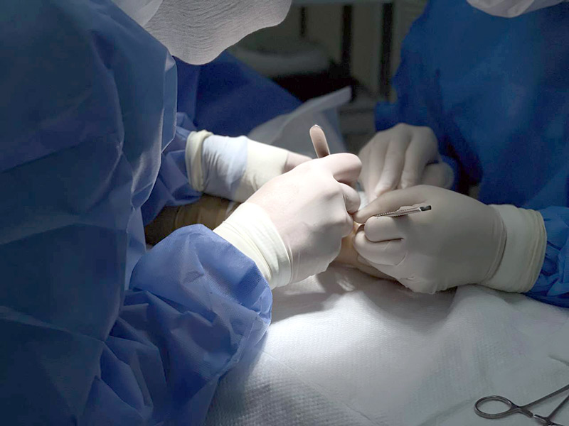 операция гигрома