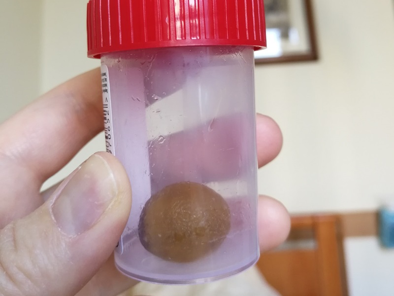 камінь з жовчного