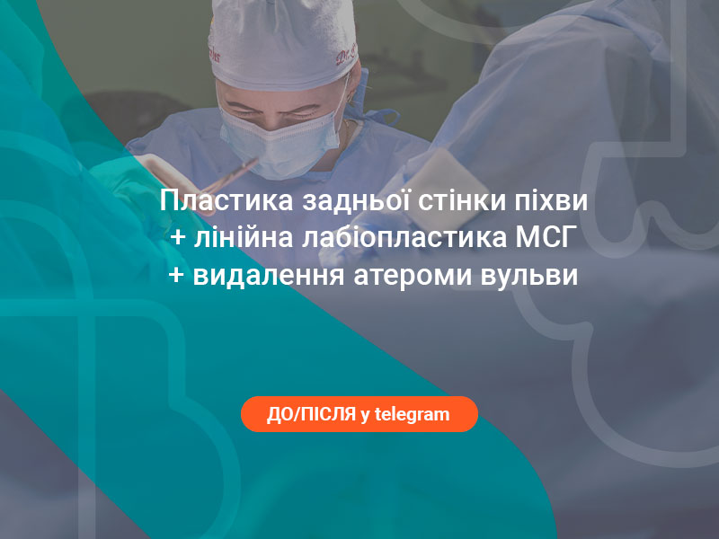 атерома вульви