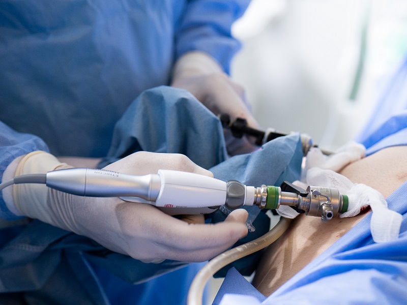 лапароскопія