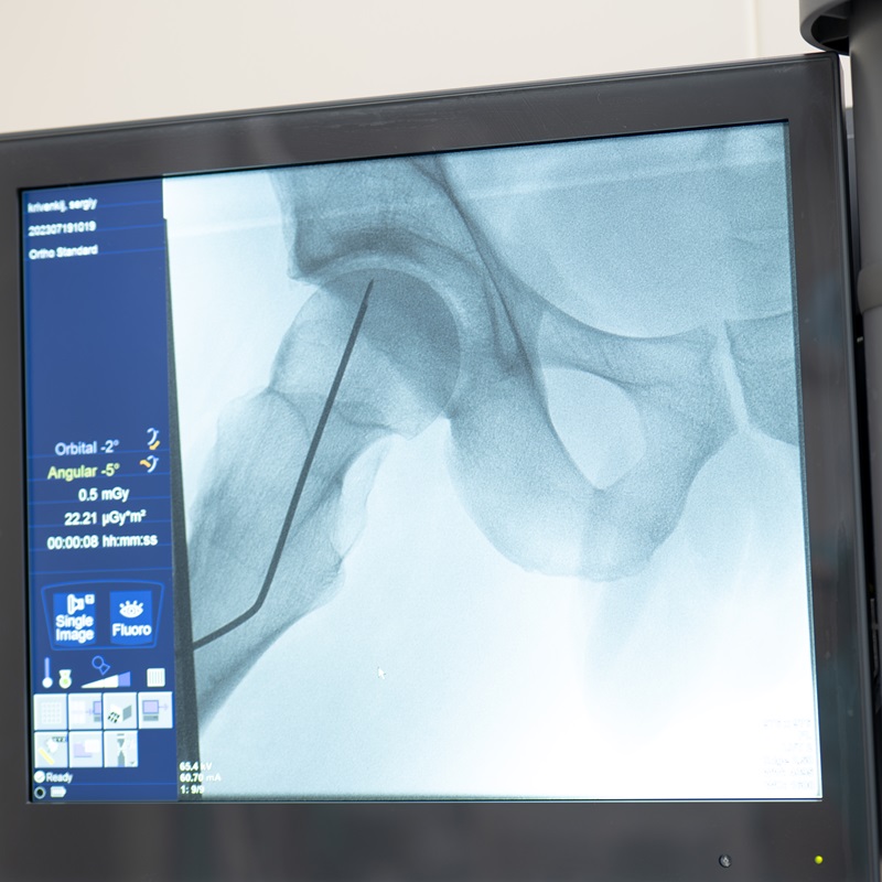 Обстеження у травматолога операція травматологія
