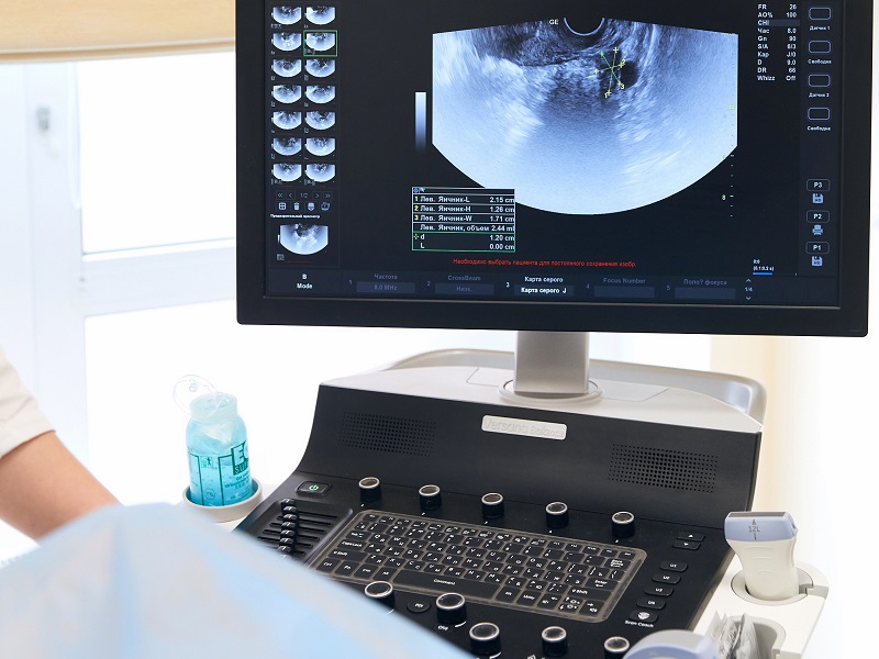 вагінальне УЗД