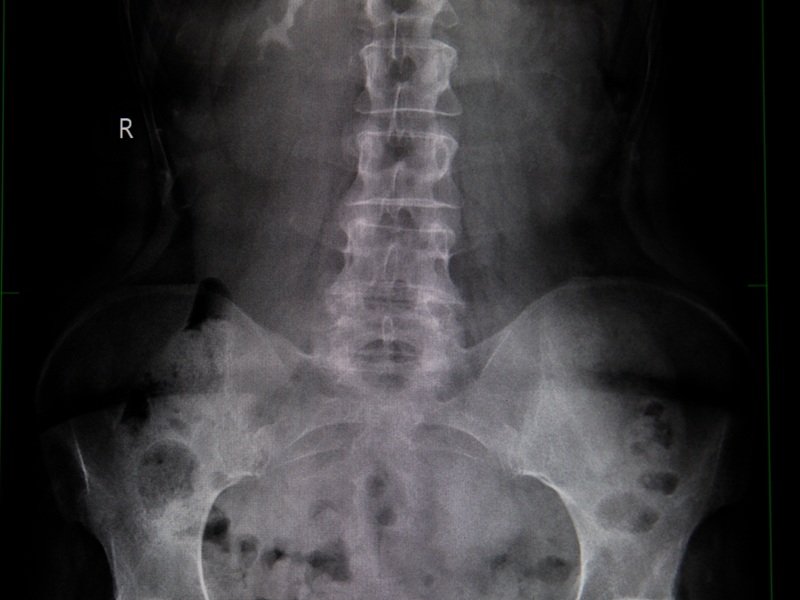 снимок таза снимок таза