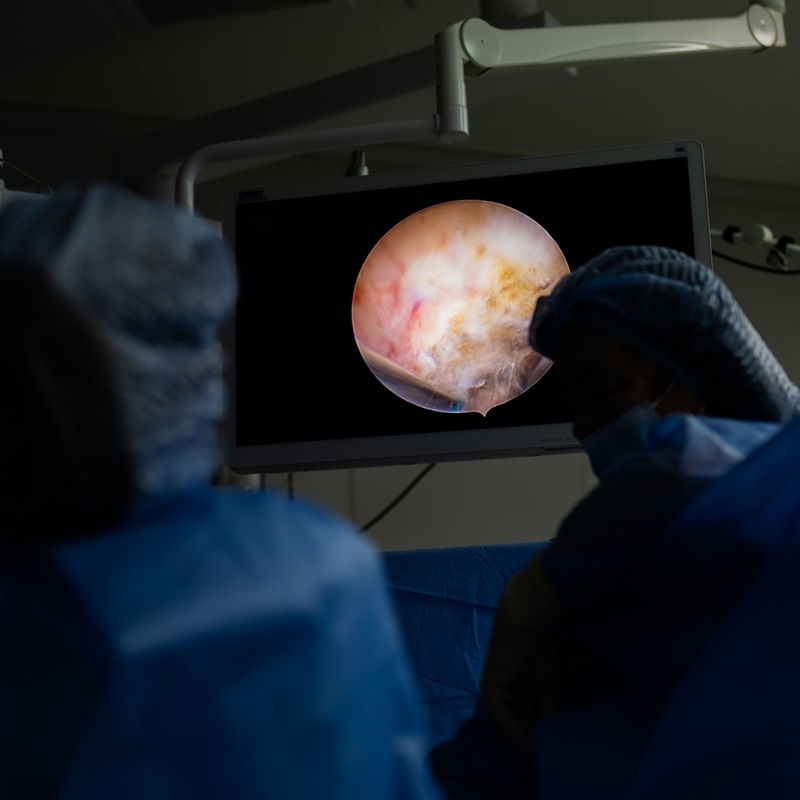 Гістерорезектоскопія гістероскопія ендоскоп