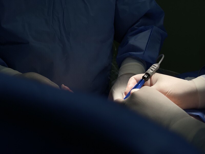 корекція соску