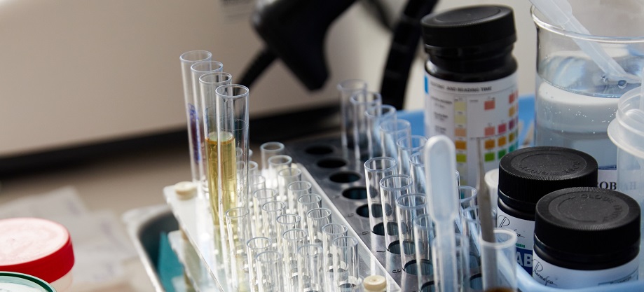 аналіз сечі в Києві