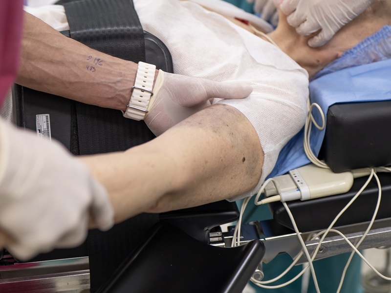 протез плече