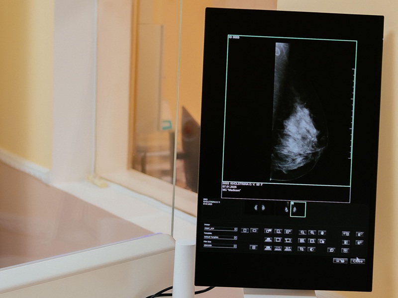 мамографія мамографія