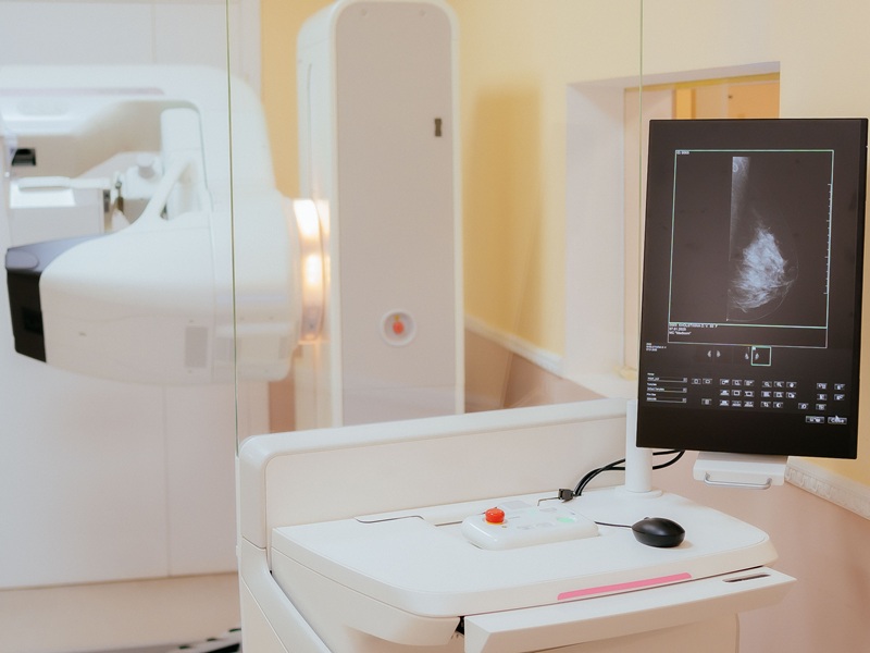 DSC09706.jpg мамографія молочних залоз