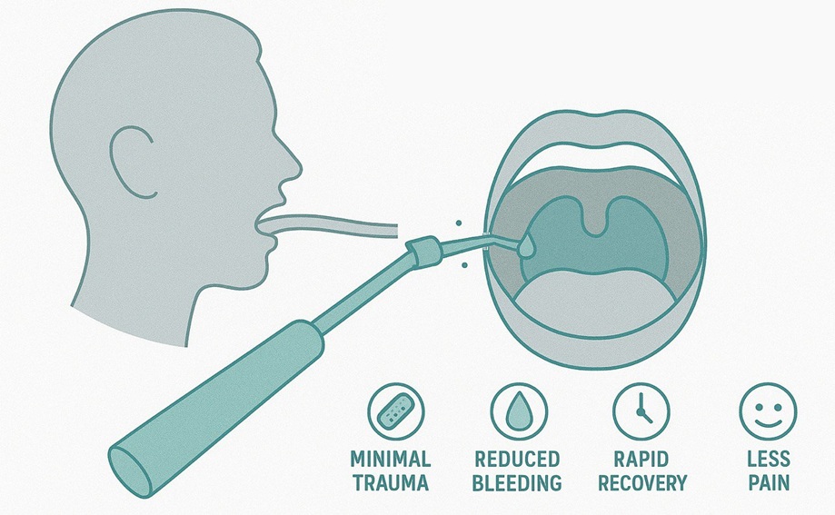 Метод кобляційної тонзилектомії кобляція